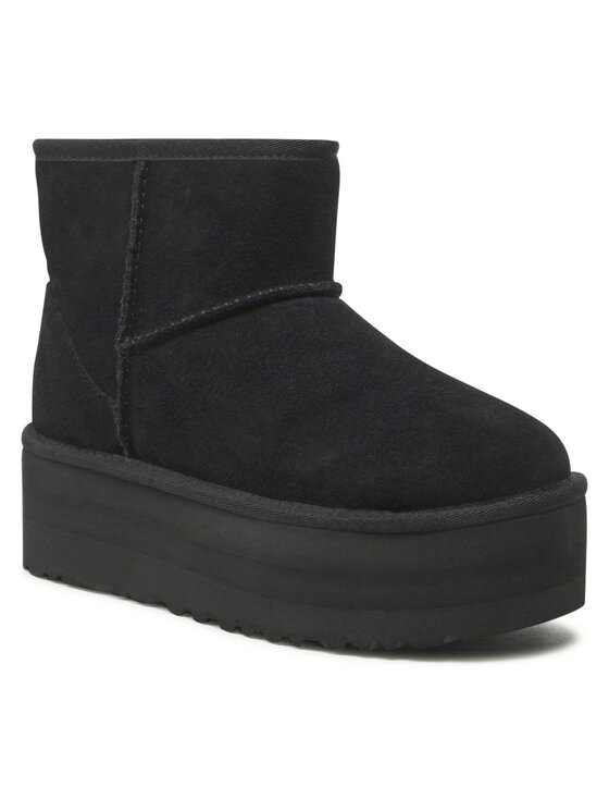 Uggs black and white top