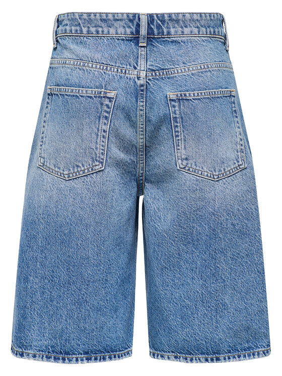 ONLY ONLY Bermudu šorti Mate 15340976 Zils Baggy Fit