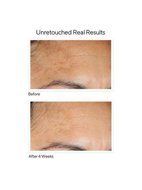 Murad Murad Environmental Shield Serum